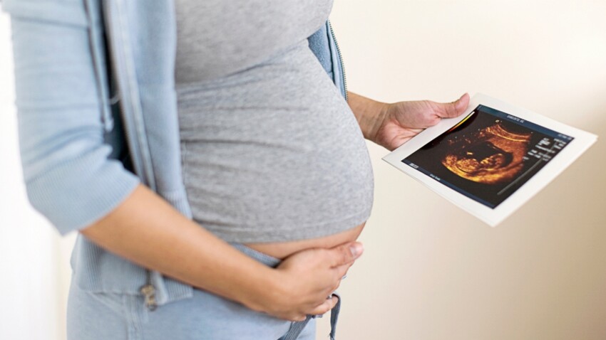 Placenta-Accreta-grossesse
