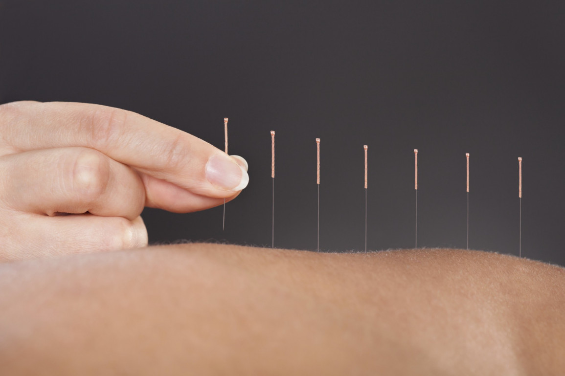 acupuncture-enceinte