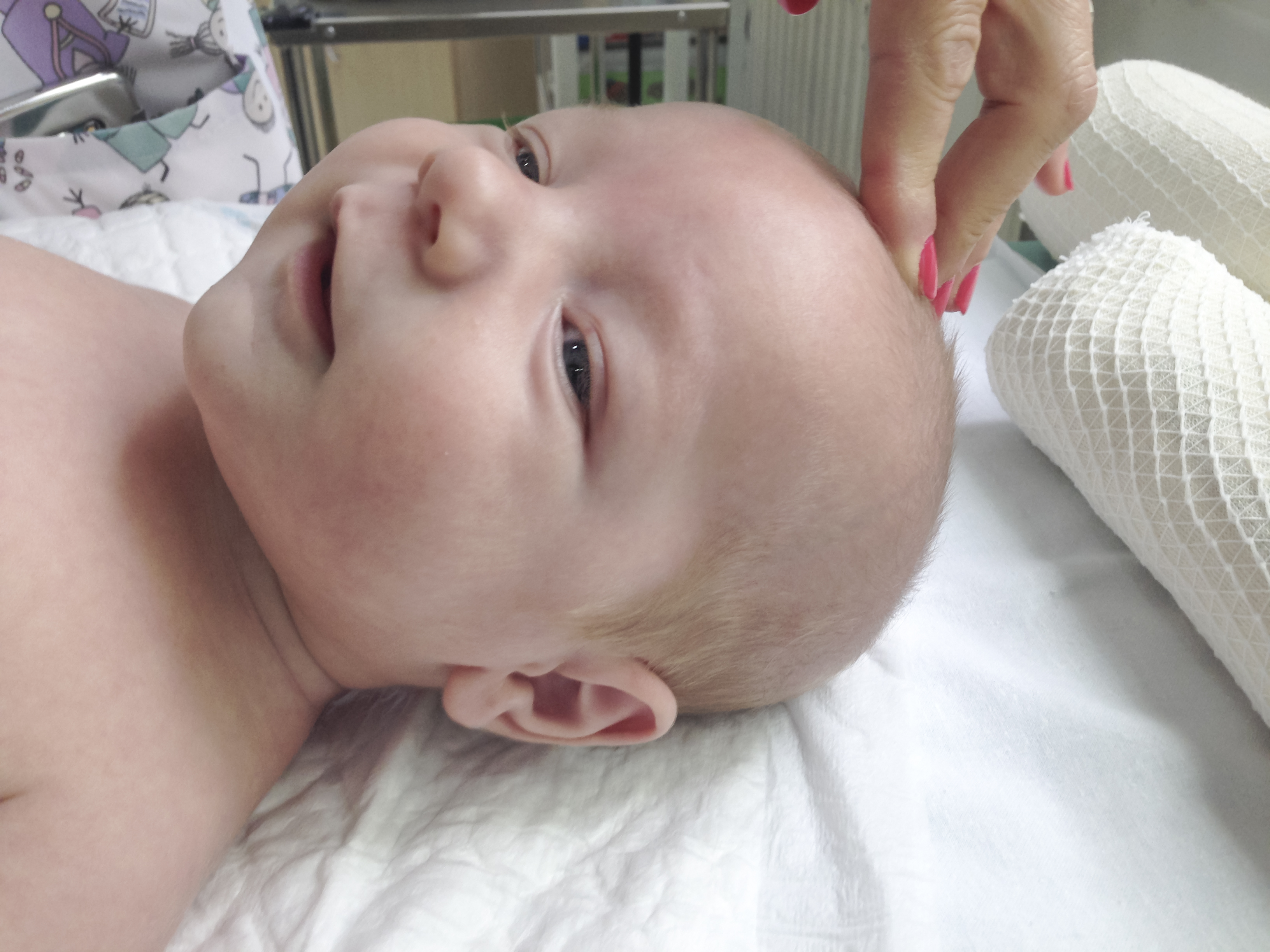 Fontanelle Bebe Chroniquesdefemmes Com Fontanelle Bebe Chroniquesdefemmes Com