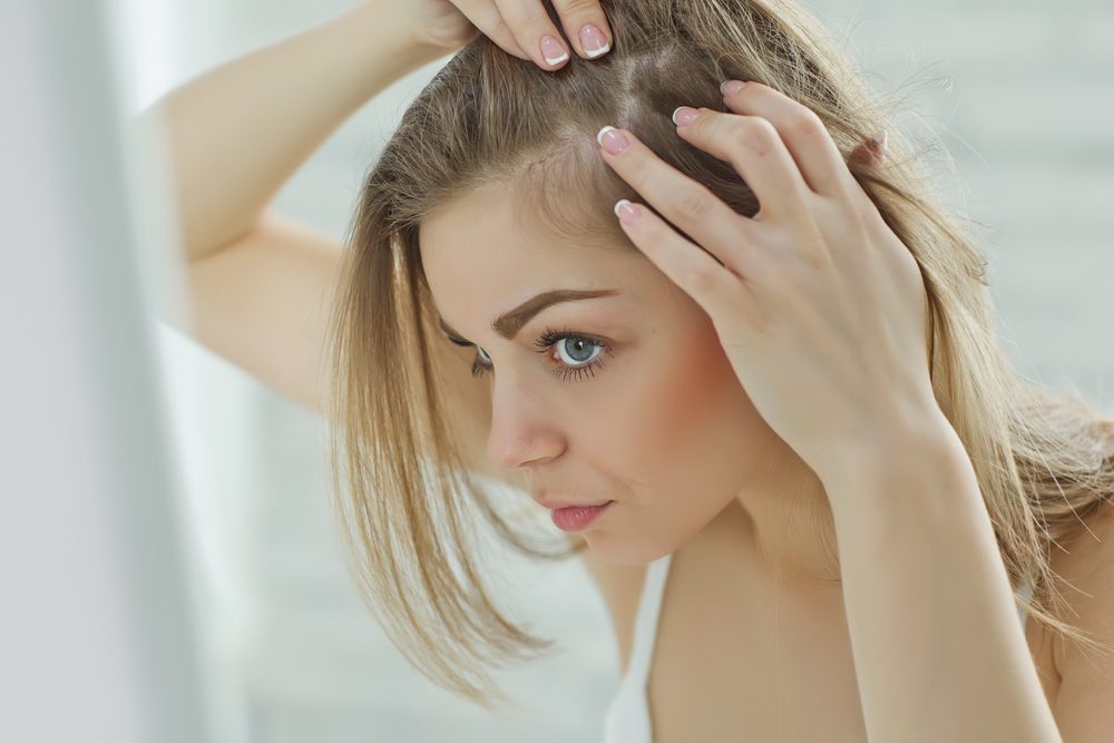 perte-de-cheveux-après-accouchement